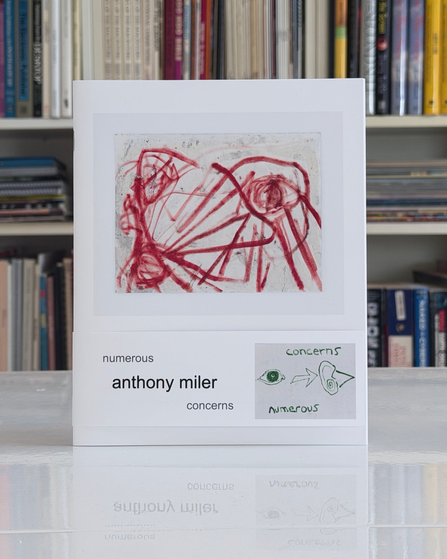 Anthony Miler: Numerous Concerns