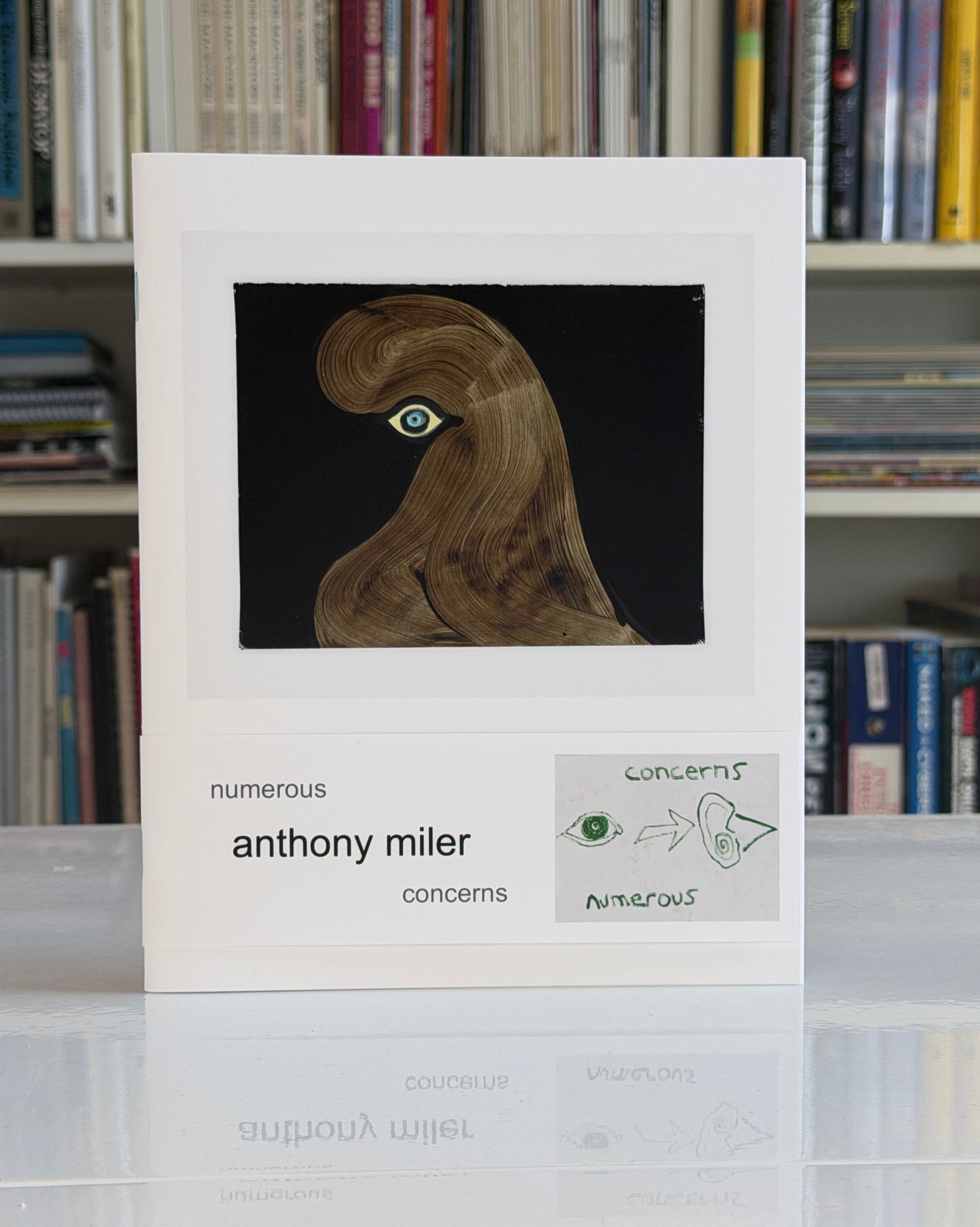 Anthony Miler: Numerous Concerns